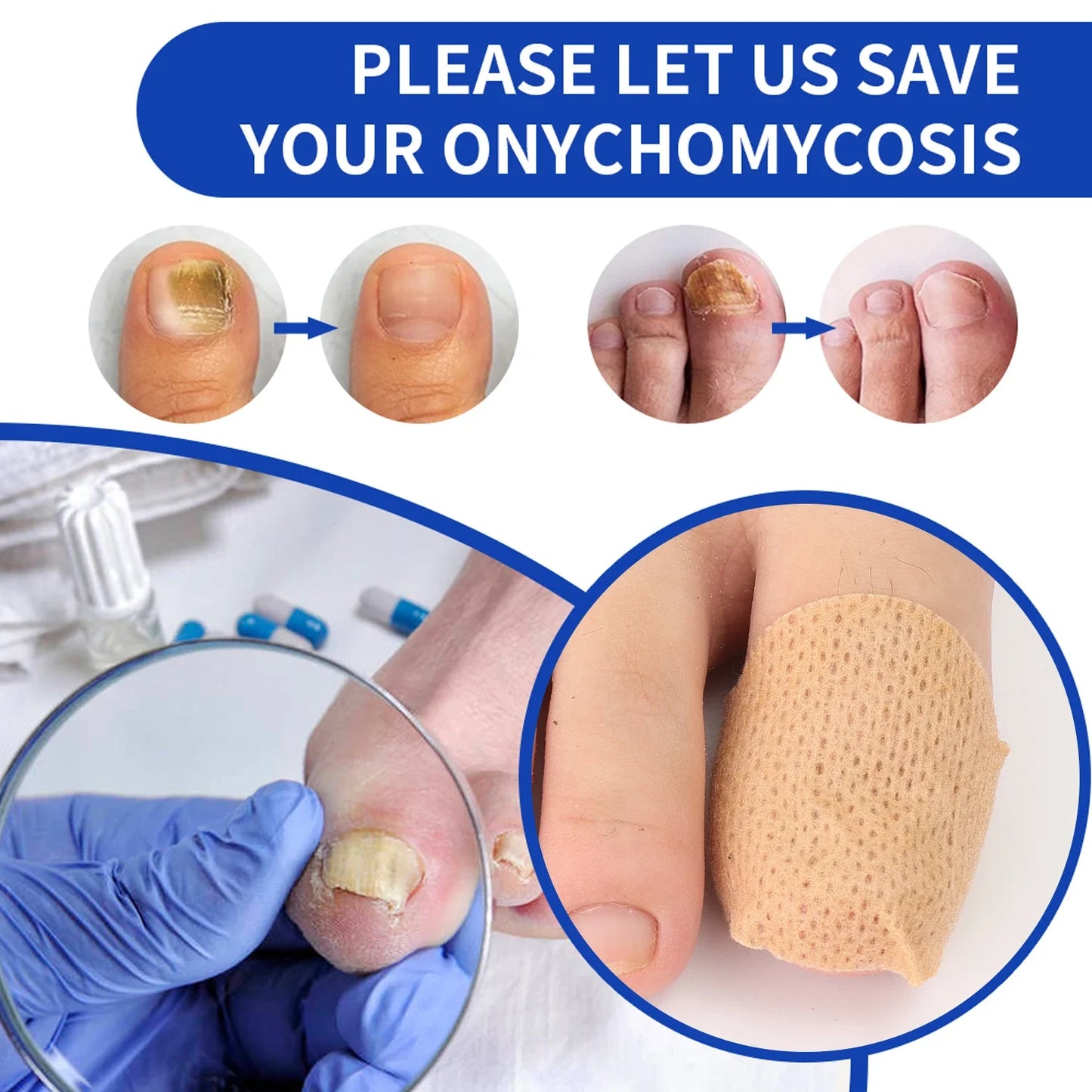 Nighttime Nail Renewal Patches™